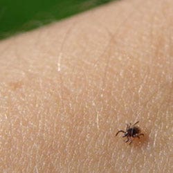 tick protection tips image